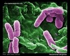 pseudomonas aeruginosa SEM micrograph